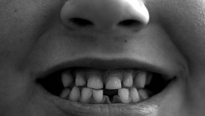 teeth health image